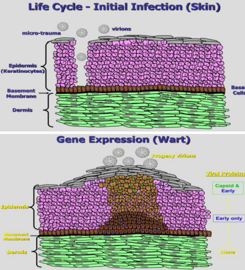 لایه بازال و ویروس HPV